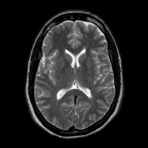 2009 MRI